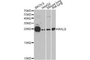 Western blot analysis of extracts of various cell lines, using RALB antibody (ABIN6293713) at 1:1000 dilution. (RALB Antikörper)