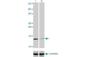 Western Blotting (WB) image for anti-beta-2-Microglobulin (B2M) (AA 1-119) antibody (ABIN560019)