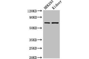 Western Blot Positive WB detected in: HEK293 whole cell lysate, Mouse kidney tissue All lanes: RABGGTA antibody at 1. (RABGGTA Antikörper  (AA 1-200))