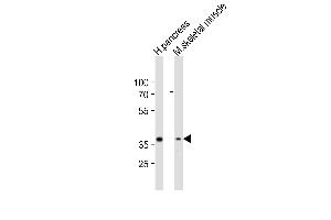 Western blot analysis of lysates from human pancreas, mouse skeletal muscle tissue lysate (from left to right), using B4GALT7 Antibody (C-term) (ABIN6243577 and ABIN6577900). (B4GALT7 Antikörper  (C-Term))