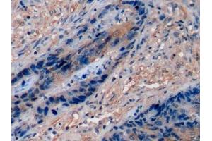 Immunohistochemistry (IHC) image for anti-Fucosyltransferase 4 (Alpha (1,3) Fucosyltransferase, Myeloid-Specific) (FUT4) (AA 264-497) antibody (ABIN7433084)