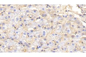 Immunohistochemistry (IHC) image for anti-Hemoglobin antibody (ABIN7437236)