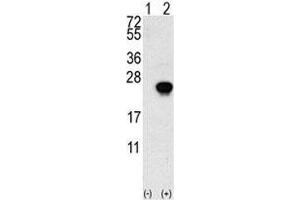 Western blot analysis of FGF1 antibody and 293 cell lysate (2 ug/lane) either nontransfected (Lane 1) or transiently transfected with the FGF1 gene (2).