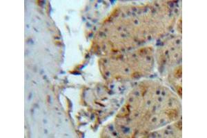 Used in DAB staining on fromalin fixed paraffin-embedded Stomach tissue (SIRT2 Antikörper  (AA 65-340))