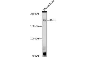 Western blot analysis of extracts of Mouse brain, using J antibody (ABIN6129289, ABIN6142633, ABIN6142635 and ABIN6216495) at 1:1000 dilution. (JAG1 Antikörper  (AA 34-180))