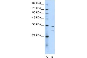 WB Suggested Anti-BXDC5 Antibody Titration:  0. (RPF1 Antikörper  (N-Term))