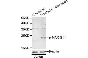 Western blot analysis of extracts of Jurkat cells, using Phospho-MAX-S11 antibody (ABIN5969917) at 1/1000 dilution. (MAX Antikörper  (pSer11))
