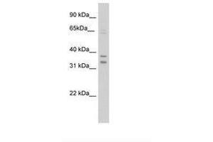Image no. 2 for anti-Nuclear Receptor Subfamily 1, Group I, Member 3 (NR1I3) (C-Term) antibody (ABIN202337)