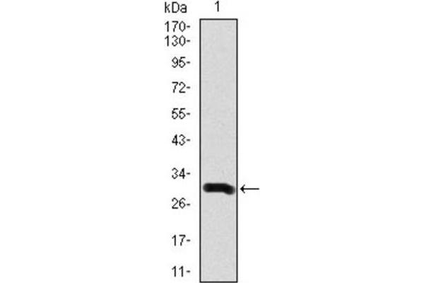 Doublecortin Antikörper  (AA 362-411)
