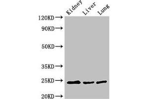 Western Blot Positive WB detected in: Mouse kidney tissue, Mouse liver tissue, Rat lung tissue All lanes: RAB5A antibody at 3 μg/mL Secondary Goat polyclonal to rabbit IgG at 1/50000 dilution Predicted band size: 24, 23 kDa Observed band size: 24 kDa (RAB5 Antikörper  (AA 1-215))