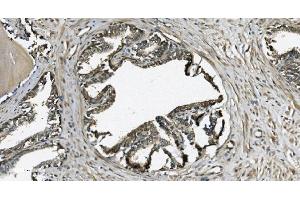 IHC analysis of GRSF1 using anti-GRSF1 antibody (ABIN7599803).