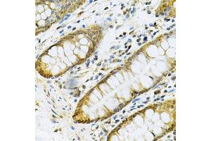 Immunohistochemistry (Paraffin-embedded Sections) (IHC (p)) image for anti-Phosphoglycerate Kinase 1 (PGK1) (AA 1-417) antibody (ABIN6145504)