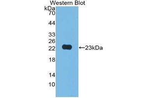 Detection of Recombinant JAM2, Human using Polyclonal Antibody to Junctional Adhesion Molecule 2 (JAM2) (JAM2 Antikörper  (AA 74-250))