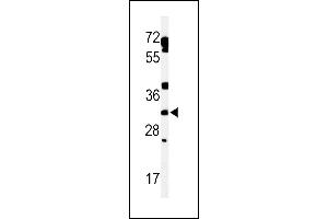 Western blot analysis of lysate from human heart tissue lysate, using TBCD7 Antibody (Center) (ABIN653858 and ABIN2843117). (TBC1D7 Antikörper  (AA 150-179))