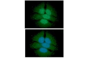 ICC/IF analysis of UGDH in HeLa cells line, stained with DAPI (Blue) for nucleus staining and monoclonal anti-human UGDH antibody (1:100) with goat anti-mouse IgG-Alexa fluor 488 conjugate (Green). (UGDH Antikörper)