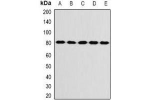 Western blot analysis of KIF3A expression in SW480 (A), SKOV3 (B), mouse brain (C), mouse ovary (D), rat liver (E) whole cell lysates. (KIF3A Antikörper)