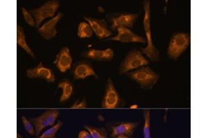 Immunofluorescence analysis of U-2 OS cells using EIF5B Polyclonal Antibody at dilution of 1:100.
