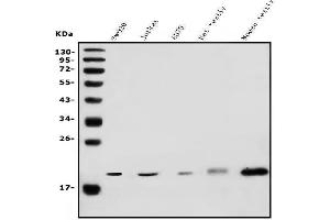 Western blot analysis of DR1 using anti-DR1 antibody (ABIN7602313).