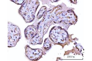 IHC analysis of RRP1 using anti-RRP1 antibody (ABIN7600683).