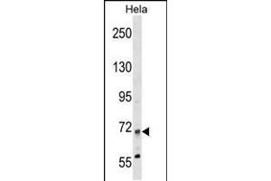 Western blot analysis in Hela cell line lysates (35ug/lane). (MTMR14 Antikörper  (N-Term))