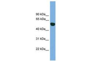 Image no. 1 for anti-Epoxide Hydrolase 1, Microsomal (Xenobiotic) (EPHX1) (AA 35-84) antibody (ABIN6745051) (EPHX1 Antikörper  (AA 35-84))