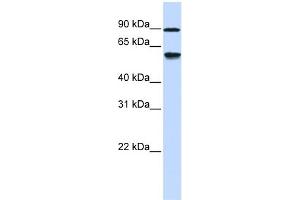 WB Suggested Anti-ADHFE1 Antibody Titration: 0. (ADHFE1 Antikörper  (Middle Region))