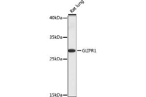 Western blot analysis of extracts of rat lung, using GLIPR1 antibody (ABIN7267387) at 1:1000 dilution. (GLIPR1 Antikörper  (AA 22-140))