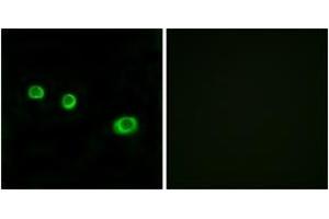 Immunofluorescence analysis of MCF7 cells, using GBP1 Antibody. (GBP1 Antikörper  (AA 71-120))