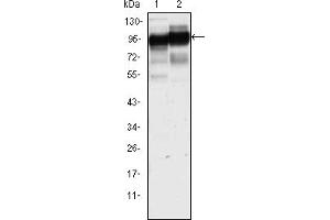 Western blot analysis using CD44 mouse mAb against Hela (1) and HUVE-12(2) cell lysate. (CD44 Antikörper)