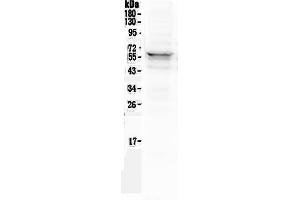 Western blot analysis of Lyn using anti-Lyn antibody .