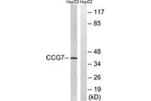 Western Blotting (WB) image for anti-Calcium Channel, Voltage-Dependent, gamma Subunit 7 (CACNG7) (AA 198-247) antibody (ABIN2890689)