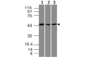 Image no. 1 for anti-SRY (Sex Determining Region Y)-Box 11 (SOX11) (AA 23-236) antibody (ABIN5027536) (SOX11 Antikörper  (AA 23-236))