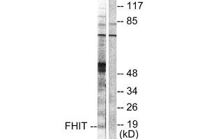 Western Blotting (WB) image for anti-Fragile Histidine Triad (FHIT) (Internal Region) antibody (ABIN1848544) (FHIT Antikörper  (Internal Region))