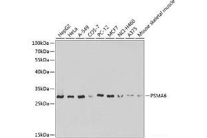 Western blot analysis of extracts of various cell lines using PSMA6 Polyclonal Antibody at dilution of 1:1000. (PSMA6 Antikörper)