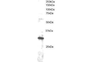Image no. 1 for anti-Dickkopf Homolog 4 (Xenopus Laevis) (DKK4) (C-Term) antibody (ABIN374183)
