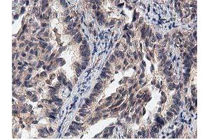 Image no. 2 for anti-Acyl-CoA Thioesterase 12 (ACOT12) antibody (ABIN1496414) (ACOT12 Antikörper)