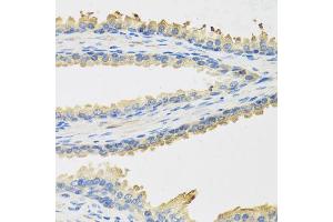 Immunohistochemistry of paraffin-embedded human prostate using LEP antibody (ABIN5973313) at dilution of 1/100 (40x lens). (Leptin Antikörper)