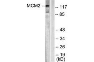 Western blot analysis of extracts from 293 cells, using MCM2 Antibody. (MCM2 Antikörper  (AA 1-50))