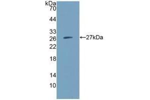 Detection of Recombinant IGSF16, Human using Polyclonal Antibody to CD300 Antigen Like Family Member C (CD300c) (CD300c Antikörper  (AA 21-183))