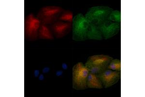 ABIN6257106 and ABIN6275018 staining  cells by IF/ICC.