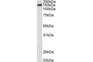 AP31703PU-N (0. (ATP2B1 Antikörper  (Internal Region))