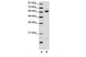 Image no. 1 for anti-Thyroid Hormone Receptor Interactor 4 (TRIP4) (AA 191-240) antibody (ABIN202787) (TRIP4 Antikörper  (AA 191-240))