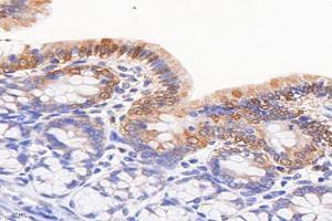 Immunohistochemistry analysis of paraffin-embedded rat colonitis using,FGF10 (ABIN7073940) at dilution of 1: 8000 (FGF10 Antikörper)