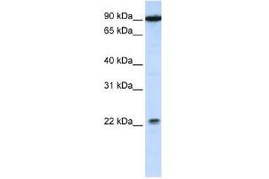 TMTC4 antibody used at 1 ug/ml to detect target protein. (TMTC4 Antikörper  (C-Term))