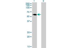Western Blot analysis of AGER expression in transfected 293T cell line by AGER monoclonal antibody (M05), clone 1D1. (RAGE Antikörper  (AA 87-197))