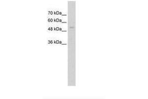 Image no. 1 for anti-Ariadne Homolog, Ubiquitin-Conjugating Enzyme E2 Binding Protein, 1 (ARIH1) (C-Term) antibody (ABIN203453)