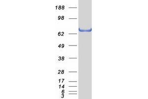 Western Blotting (WB) image for Forkhead Box P1 (FOXP1) (Transcript Variant 1) protein (Myc-DYKDDDDK Tag) (ABIN2721378)