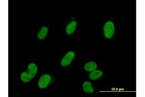 Immunofluorescence (IF) image for anti-SWI/SNF Related, Matrix Associated, Actin Dependent Regulator of Chromatin, Subfamily E, Member 1 (SMARCE1) (AA 1-411) antibody (ABIN948476)