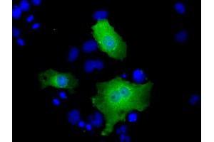 Anti-FHL1 mouse monoclonal antibody (ABIN2453043) immunofluorescent staining of COS7 cells transiently transfected by pCMV6-ENTRY FHL1 (RC203478). (FHL1 Antikörper)