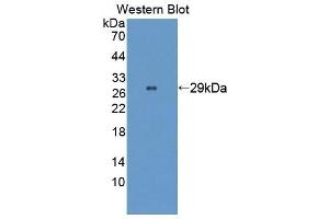 Detection of Recombinant WASP, Human using Polyclonal Antibody to Wiskott Aldrich Syndrome Protein (WASP) (WASP Antikörper  (AA 39-251))